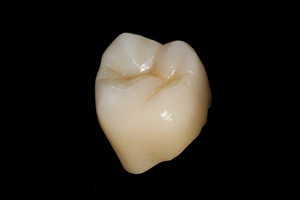 Dental Crown Types Compared: Porcelain Vs  Zirconia Vs  Metal (and How To Choose)