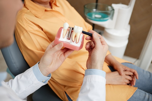 How Dental Implants Can Be Good For Your Jawbone