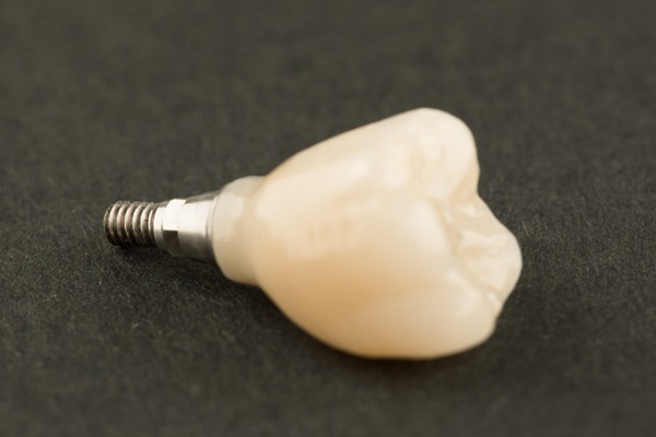 Implant Crowns: The Key To Restoring Missing Teeth