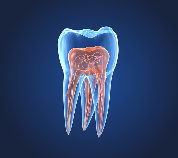 What is an Endodontist Naperville, IL A.Y. Family Dental Issues an Endodontist Treats